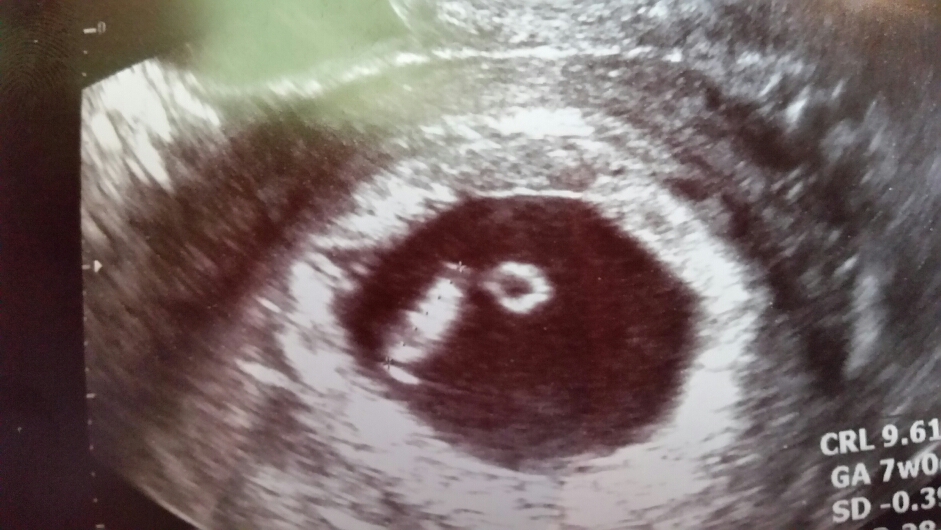 2015-11-10 15.42.41.jpg