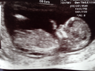 ImageUploadedByVau Foorumi1412099746.484330.jpg