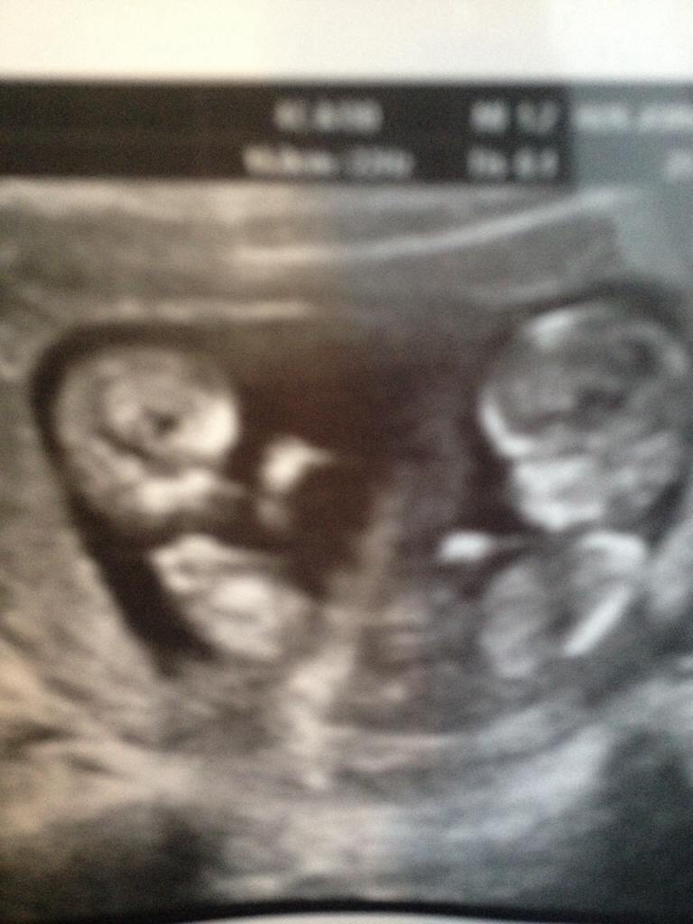 ImageUploadedByVau Foorumi1417085815.045768.jpg