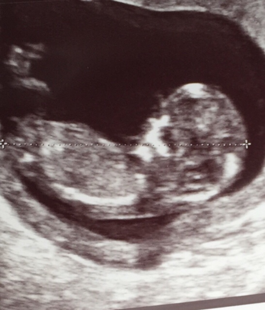 ImageUploadedByVau Foorumi1432662261.042204.jpg