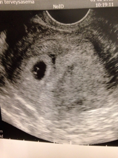 ImageUploadedByVau Foorumi1435675746.536221.jpg