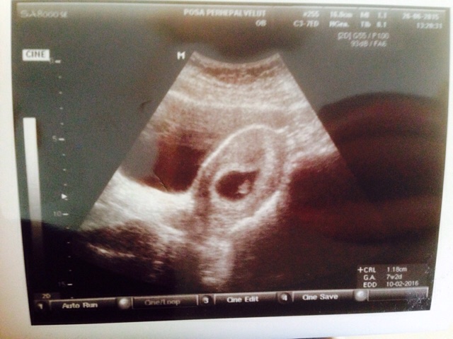 ImageUploadedByVau Foorumi1436007185.675507.jpg