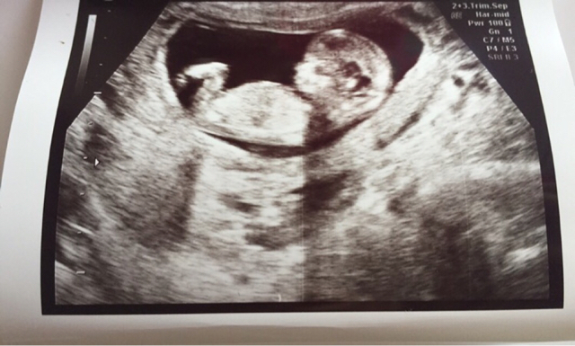 ImageUploadedByVau Foorumi1441276092.891180.jpg