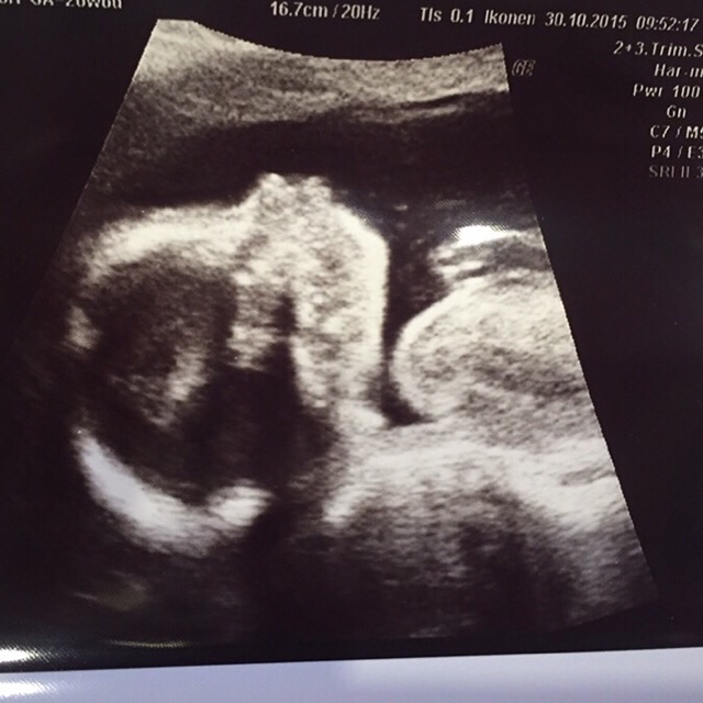 ImageUploadedByVau Foorumi1446206635.623979.jpg