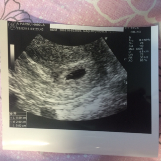 ImageUploadedByVau Foorumi1456660725.212783.jpg