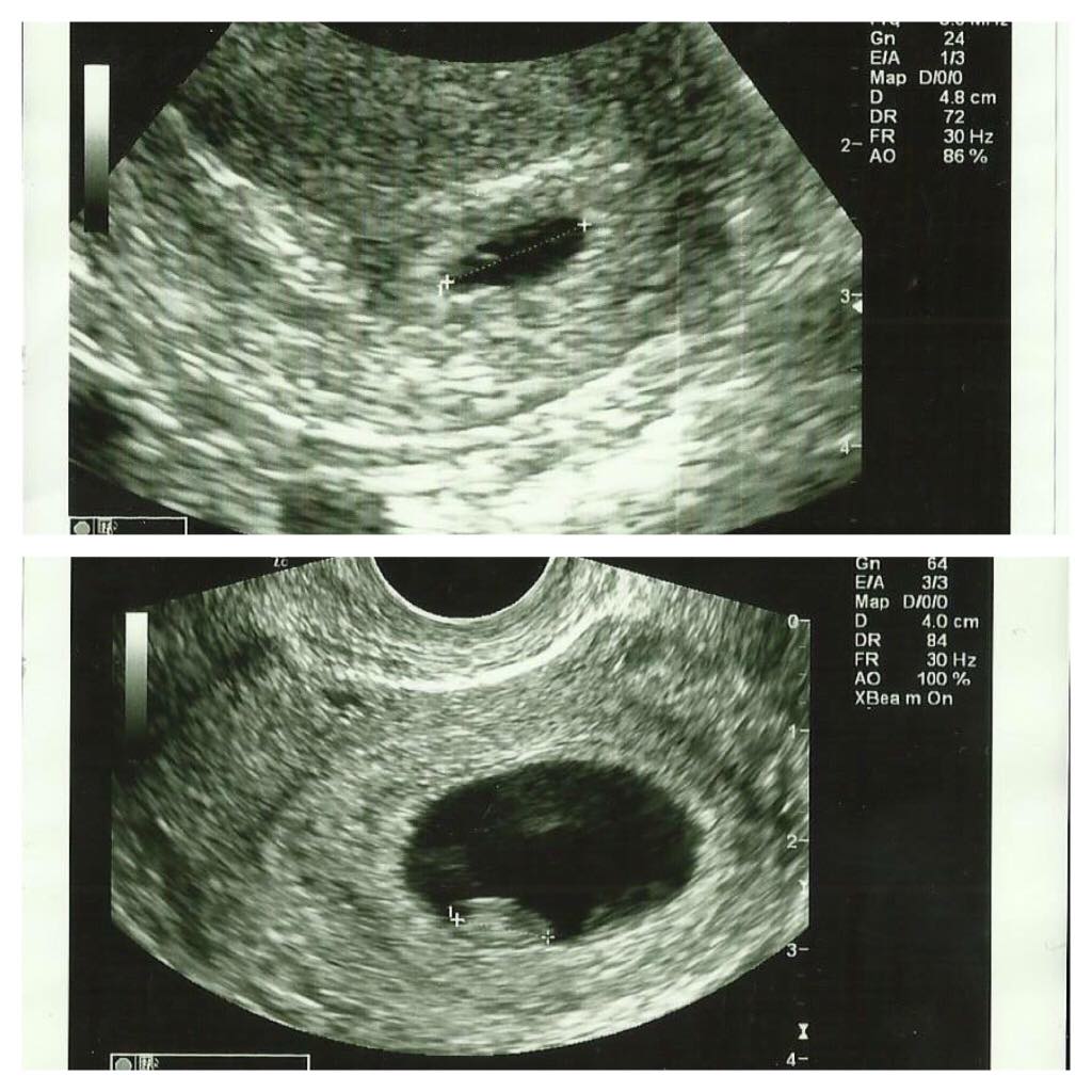 ImageUploadedByVau Foorumi1457449752.799249.jpg