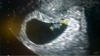 ImageUploadedByVau Foorumi1459336351.251662.jpg