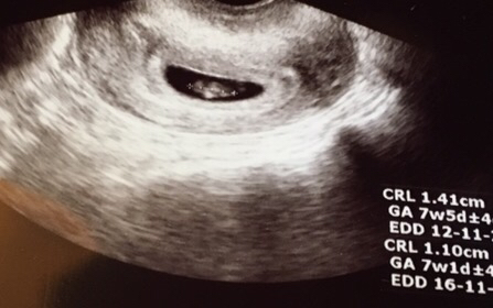 ImageUploadedByVau Foorumi1459425776.616227.jpg