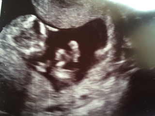 ImageUploadedByVau Foorumi1460713783.118399.jpg