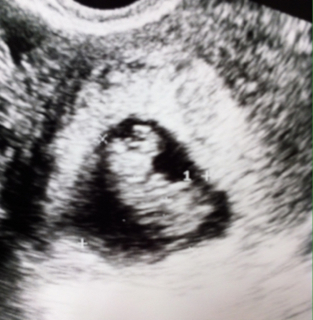 ImageUploadedByVau Foorumi1460791676.477933.jpg