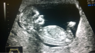 ImageUploadedByVau Foorumi1462884928.845786.jpg