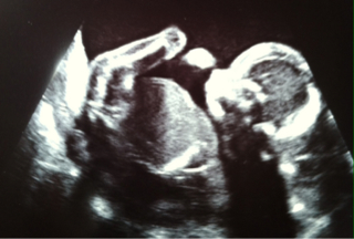 ImageUploadedByVau Foorumi1467722859.059713.jpg