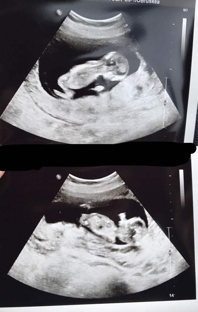 ImageUploadedByVau Foorumi1509988413.682501.jpg