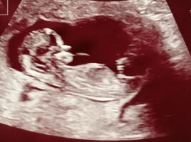 IMG_20220530_122311.jpg IMG_20220530_122311.jpg