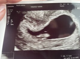 11C103B1-0183-434B-9B40-146938902979.jpeg 11C103B1-0183-434B-9B40-146938902979.jpeg