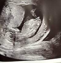 875C43BA-8F54-47D6-8DFD-F1B8450D2396.jpeg 875C43BA-8F54-47D6-8DFD-F1B8450D2396.jpeg