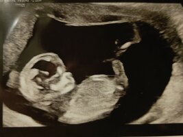 IMG_20240313_213554.jpg IMG_20240313_213554.jpg