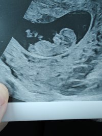 1000090865.jpg 1000090865.jpg