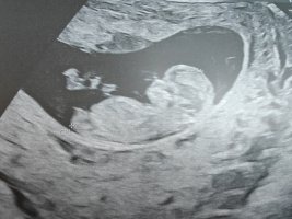 1000090867.jpg 1000090867.jpg