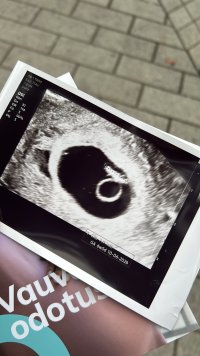 7CFFEC59-2300-49A8-BF49-06FAE7298666.jpeg 7CFFEC59-2300-49A8-BF49-06FAE7298666.jpeg