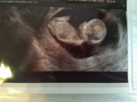 IMG_20191011_103257.jpg IMG_20191011_103257.jpg